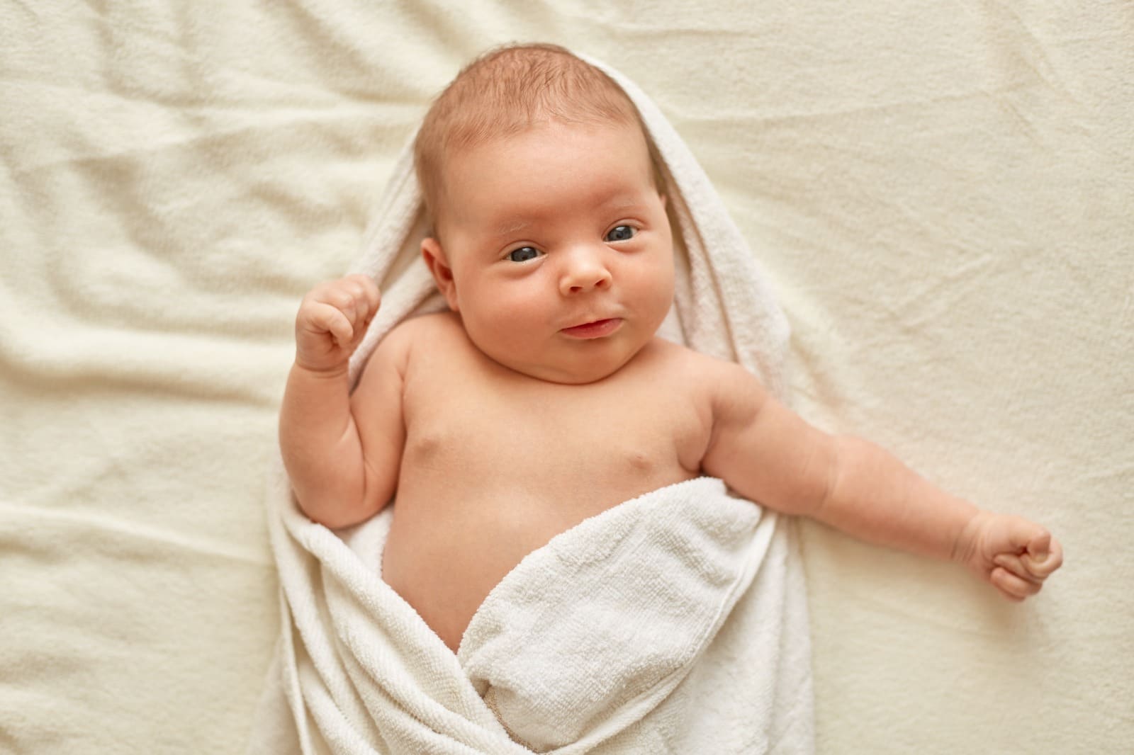 Cradle Cap In Babies Causes Ways To Overcome It