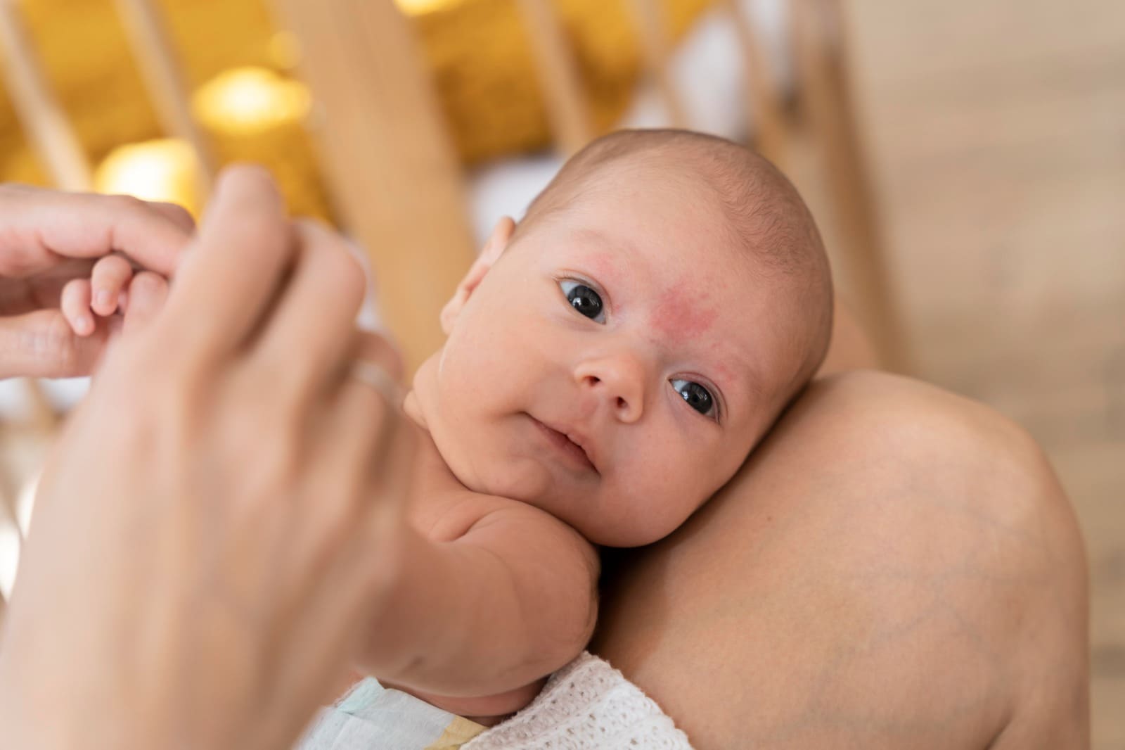 Baby Eczema Know The Causes And How To Overcome It