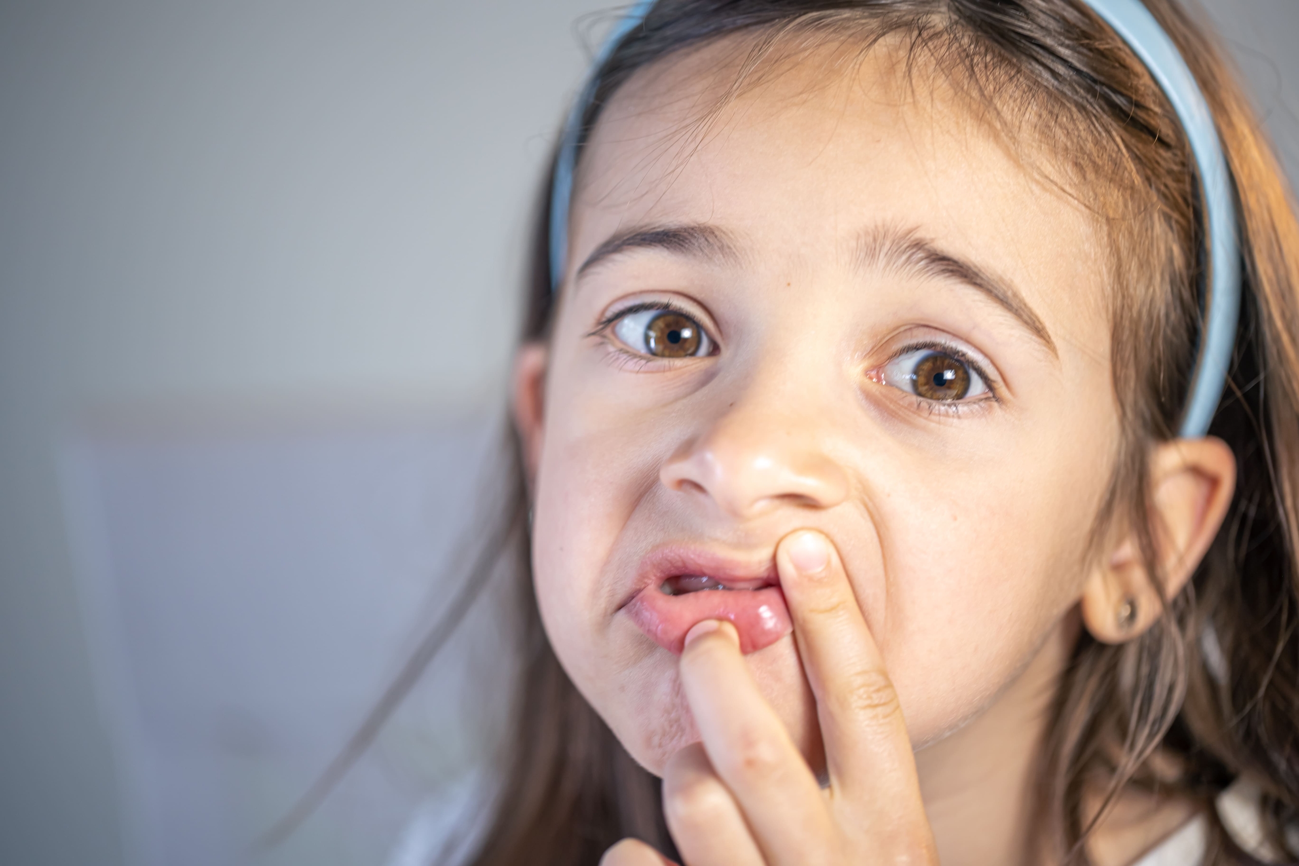 Itchy Lips In Children Causes And Solutions